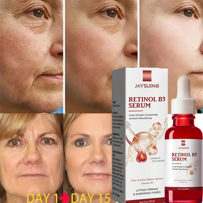 Retinol Anti-Aging Serum for Smooth, Firm Skin