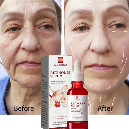 Retinol Anti-Aging Serum for Smooth, Firm Skin